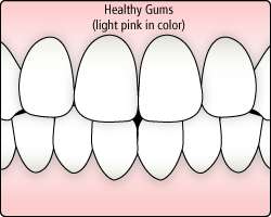 healthy gums